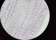 Perbedaan Pembelahan Mitosis dan Meiosis