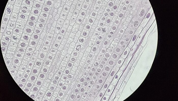 Perbedaan Pembelahan Mitosis dan Meiosis